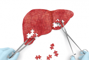 28 липня Всесвітній день боротьби з Гепатитом