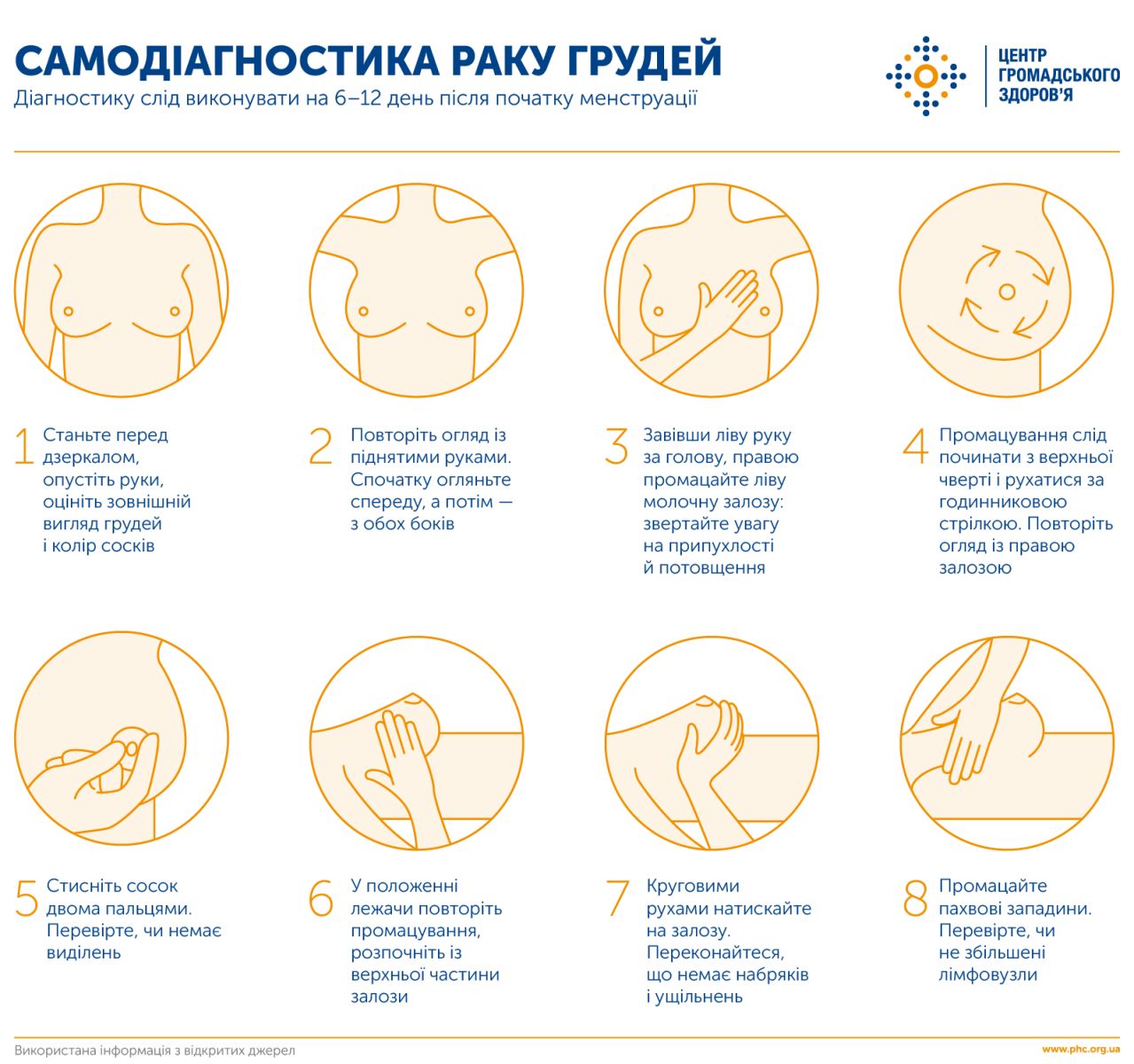 Рак молочної залози — найпоширеніше онкологічне захворювання серед жінок