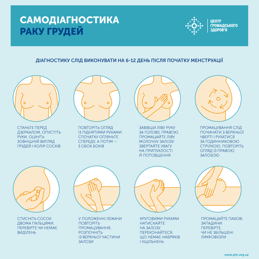 Рак молочної залози — найпоширеніше онкологічне захворювання у світі