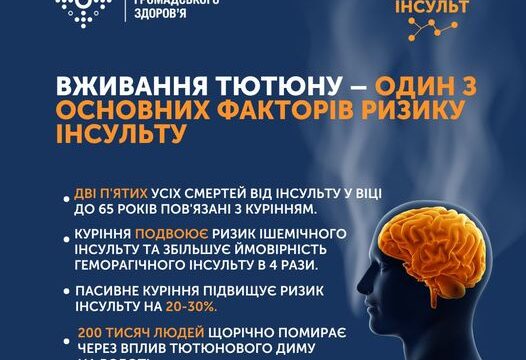 Вживання тютюну – один з основних факторів ризику інсульту