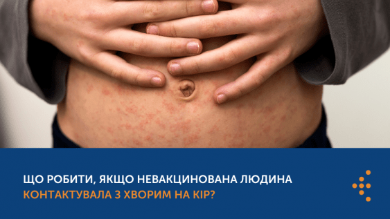 ЩО РОБИТИ, ЯКЩО НЕВАКЦИНОВАНА ЛЮДИНА КОНТАКТУВАЛА З ХВОРИМ НА КІР?