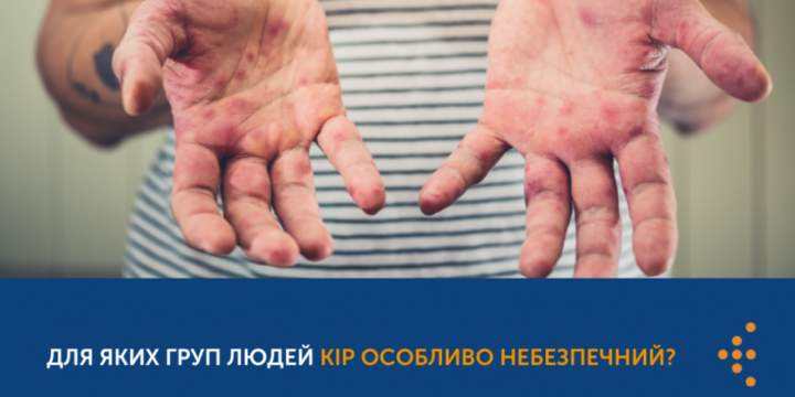 ДЛЯ ЯКИХ ГРУП ЛЮДЕЙ КІР ОСОБЛИВО НЕБЕЗПЕЧНИЙ?