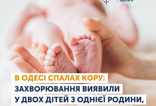 Кір: чим небезпечний та коли вакцинуватись