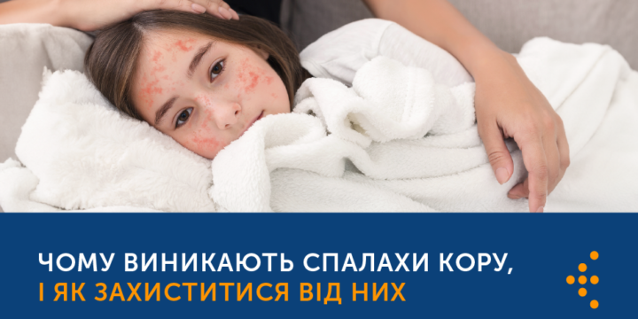 ЧОМУ ВИНИКАЮТЬ СПАЛАХИ КОРУ, І ЯК ЗАХИСТИТИСЯ ВІД НИХ