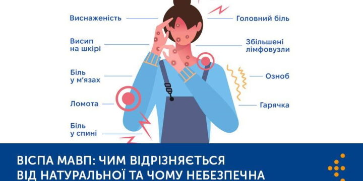 Віспа мавп: чим відрізняється від натуральної та чому небезпечна