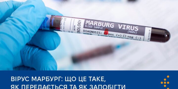 Вірус Марбург: що це таке, як передається та як запобігти
