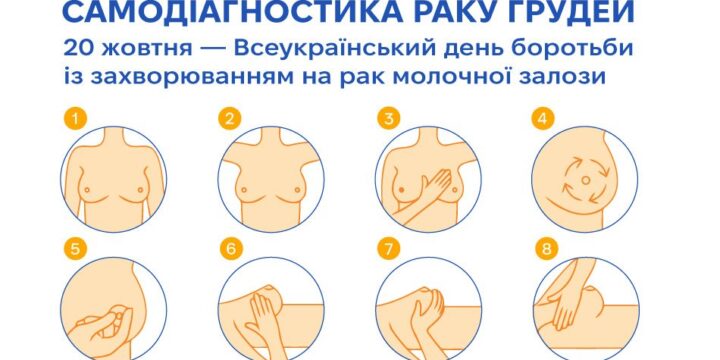 Рак молочної залози: як розпізнати та запобігти