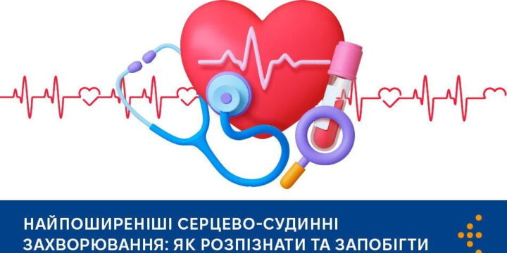 Найпоширеніші серцево-судинні захворювання: як розпізнати та запобігти