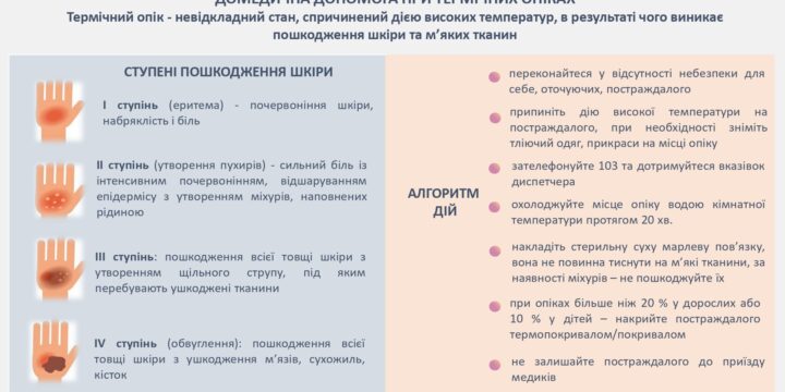 Домедична допомога при термічних опіках