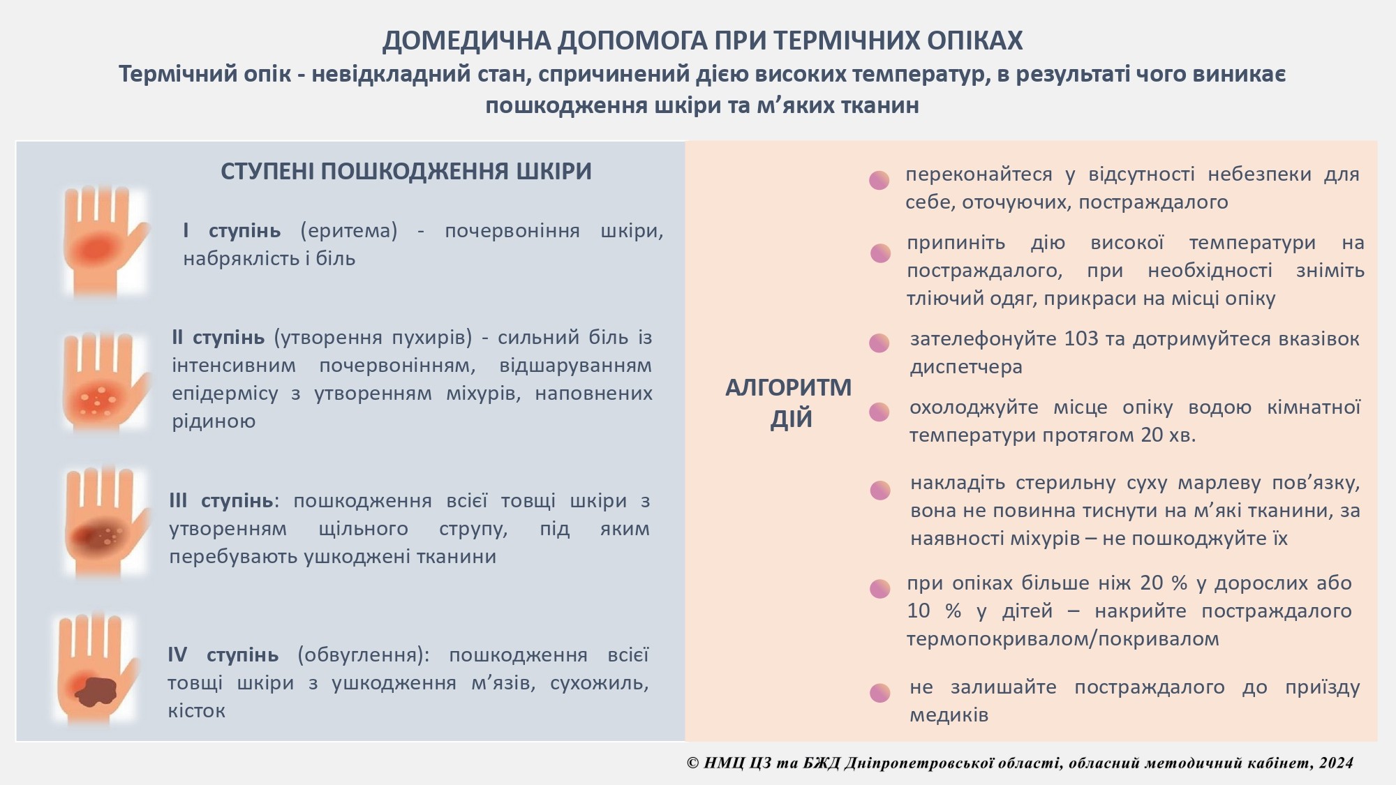 Домедична допомога при термічних опіках