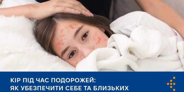 Кір під час подорожей: як убезпечити себе та близьких
