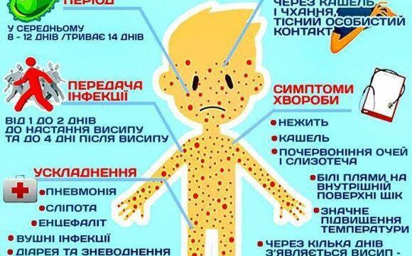 Обережно кір!
