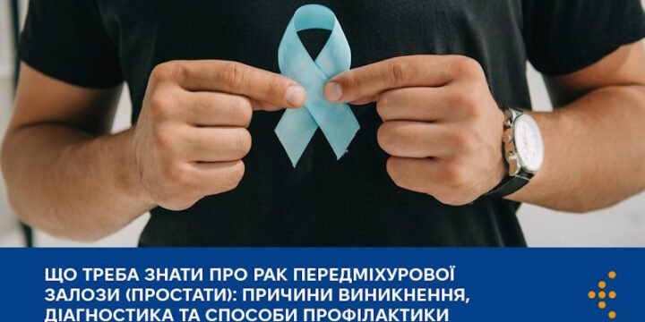 Про рак передміхурової залози (простати): причини, діагностика та профілактика