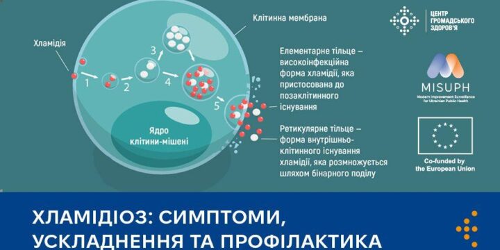 Хламідіоз: симптоми, ускладнення та профілактика