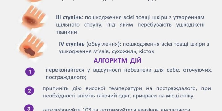 Домедична допомога при термічних опіках