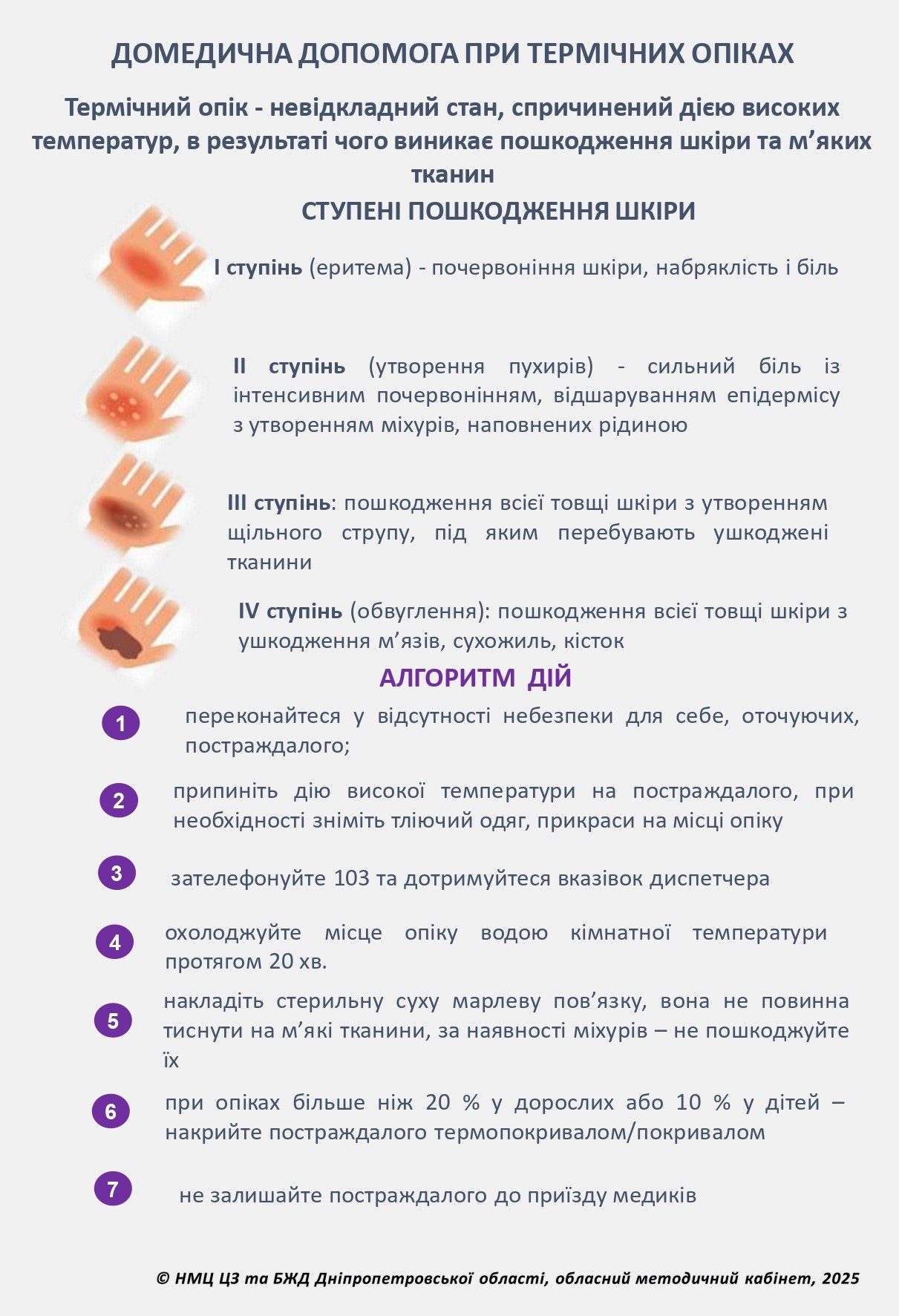 Домедична допомога при термічних опіках