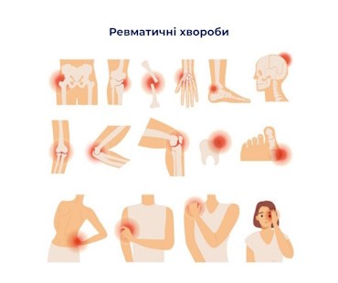 Ревматичні хвороби