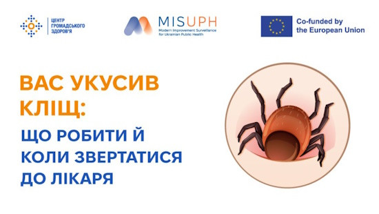 Вас укусив кліщ: що робити й коли звертатися до лікаря